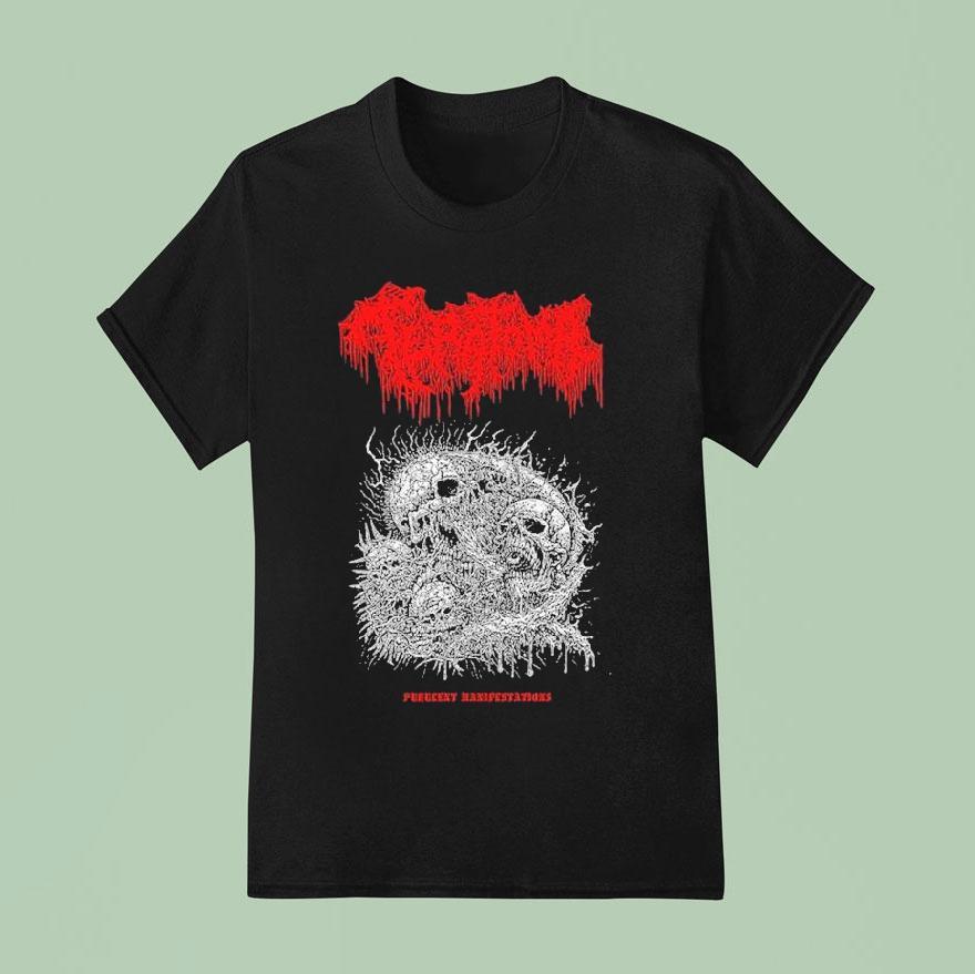 Teratoma Manifestations T Shirt