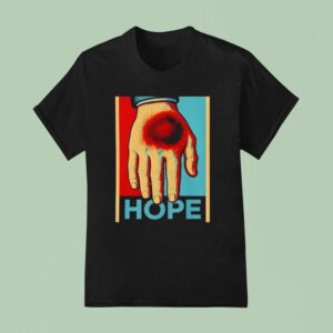 Donald Trump Bruised Hand Hope T Shirt